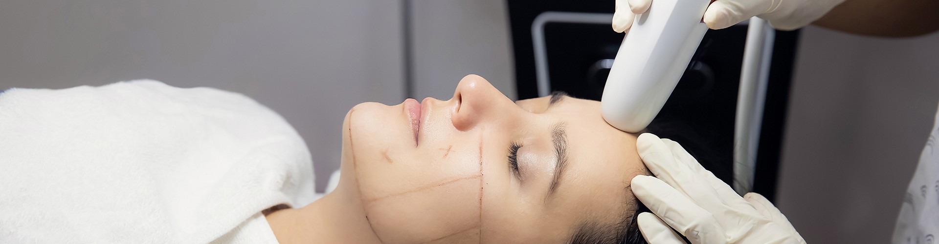 Ultherapy