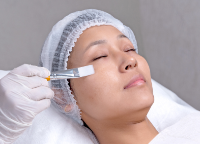 Dark Circle Reduction Peels