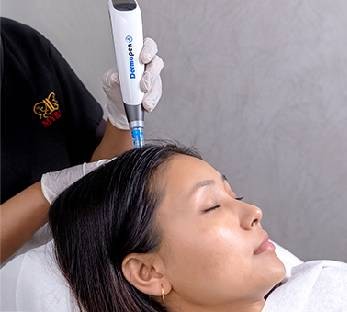 ADVANCED EXOSOMES (HAIR)